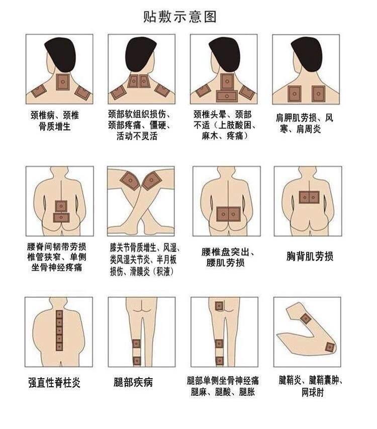 老倪膏药,百年好药 - 东论广场- 东论 东方热线·