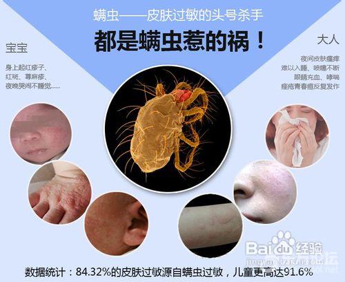 3月不晒被,600万<em>螨虫</em>陪你睡! - 生活服务- 东论